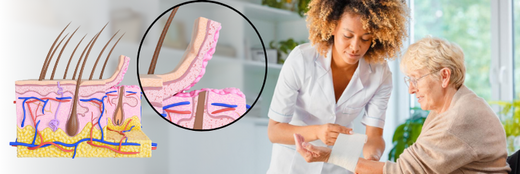 How to Manage and Prevent a Skin Tear