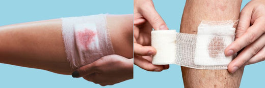Types of wound exudate and what they indicate
