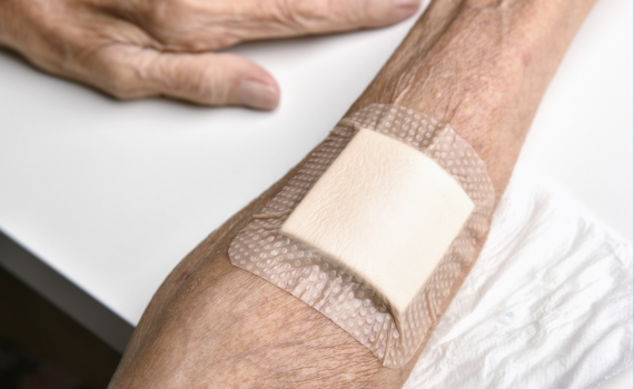 wound dressing