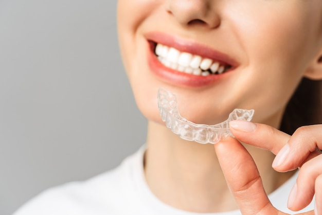 Dental Aligners