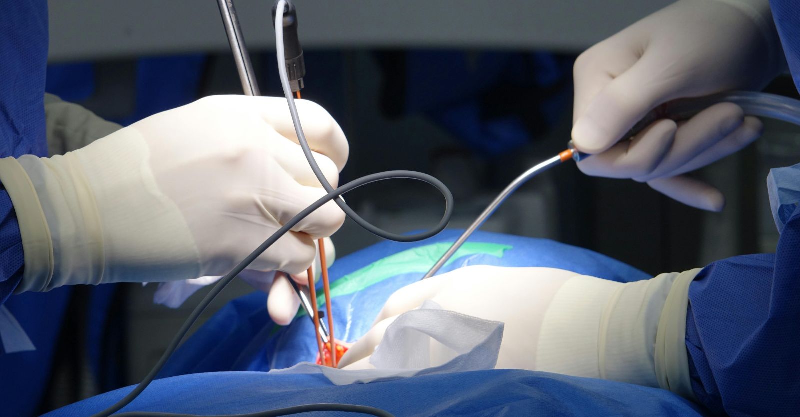 Latex-Free Long Surgical GlovesLatex-Free Long Surgical Gloves