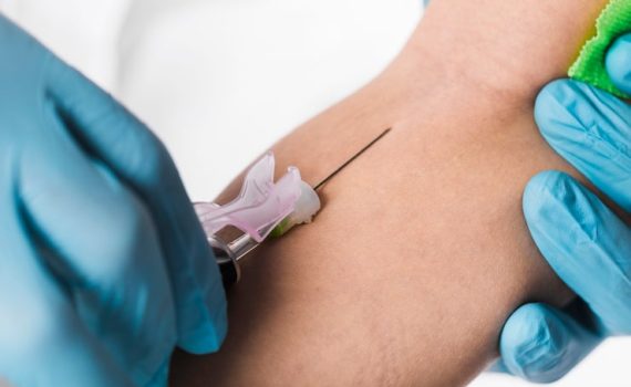 Biopsy Punches