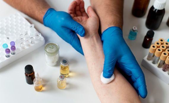Wound Infection