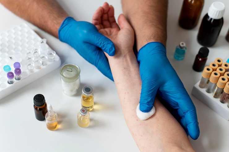 Wound Infection