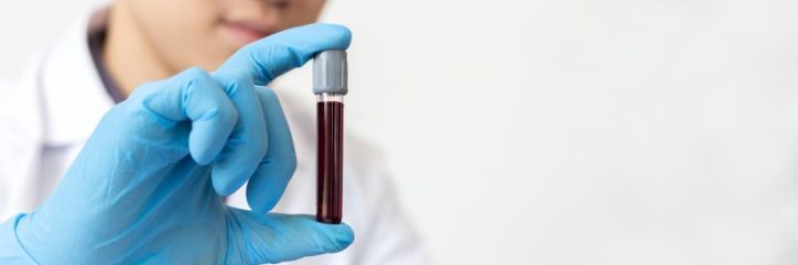 Multiple Sample Blood Collection Needle Pen: A Complete Guide