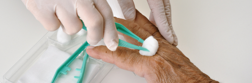 Essential Steps for Dressing a Skin Tear