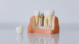 Dental > Restorative and Cosmetic Dentistry > Teeth