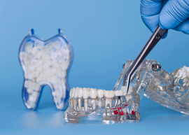 Dental Supplies > Crown & Bridge