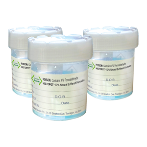 Histopots, 70ml, 10pct NBF (Neutral Buffered Formalin), Blue, 100 Pieces/Box Box