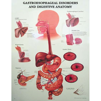 Chart Gastroesophageal Disorders Each