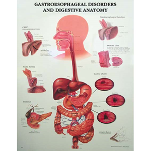 Chart Gastroesophageal Disorders Each