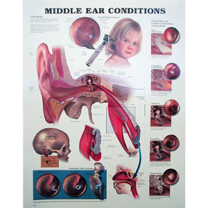 Chart Middle Ear Conditions, Each Each