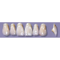 MYERSON ANTERIORS #A13/C (1x6 CARD) Card