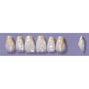 MYERSON ANTERIORS #A53/E (1x6 CARD) Card