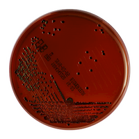 Prepared Plated Media, Eosin Methylene Blue (EMB) Agar Plates, 10 Pieces/Pack Pack