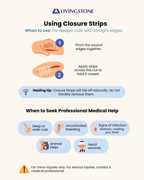 Closure Strips